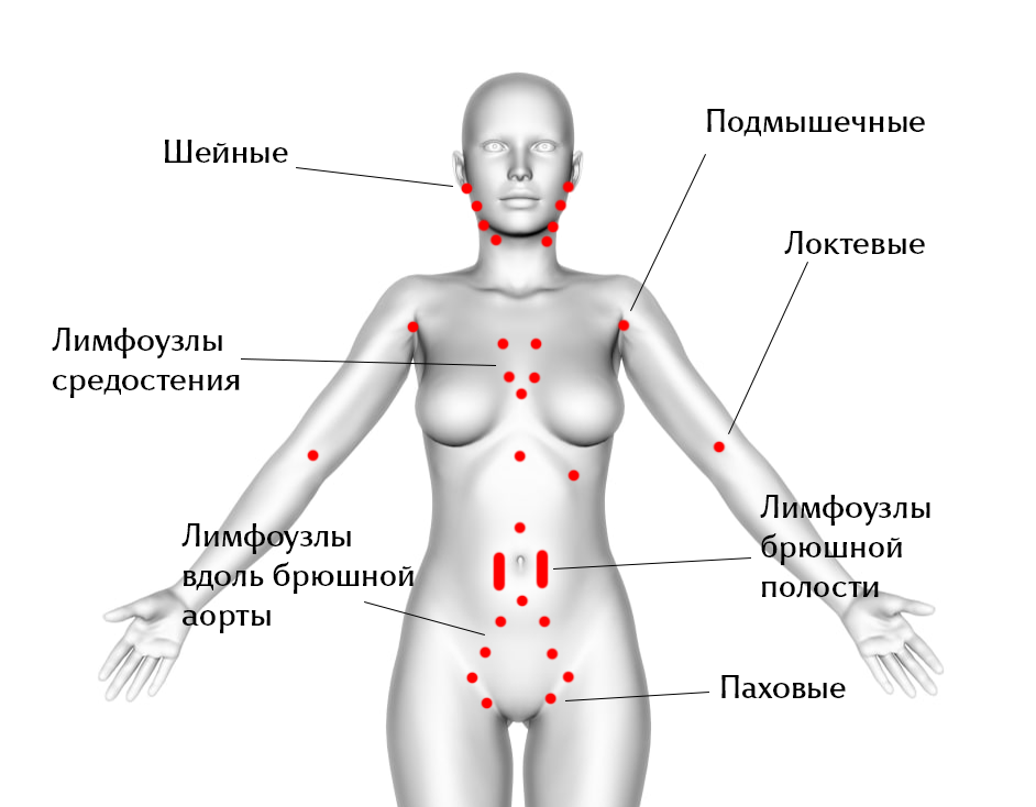 Схема расположения лимфатических узлов на теле