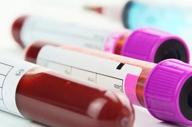    Как проверить, болел ли человек ветрянкой?