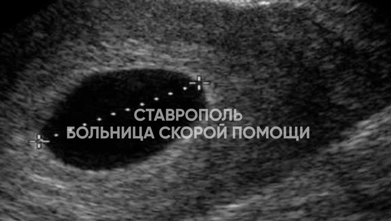      Фото: Больница скорой помощи Ставрополь