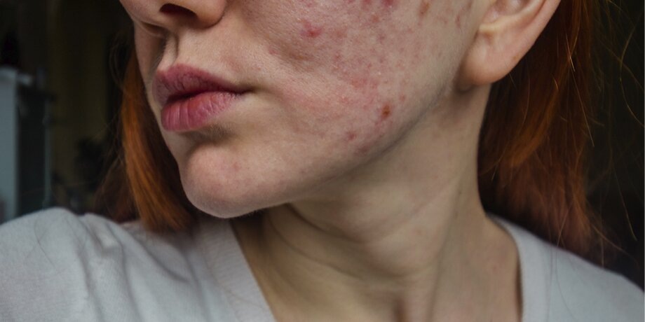    Фото: 123RF/anesteziya