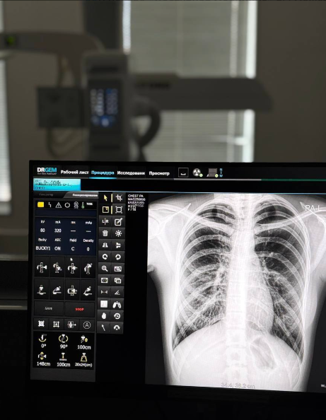 Флюорография 