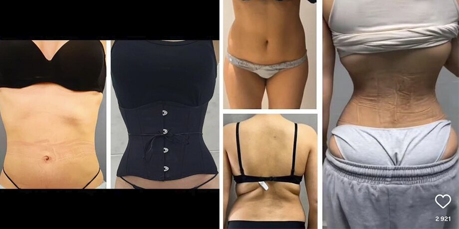    Фото: instagram.com (принадлежит Meta, признана экстремистской и запрещена на территории РФ)/kazbek.kudzaev