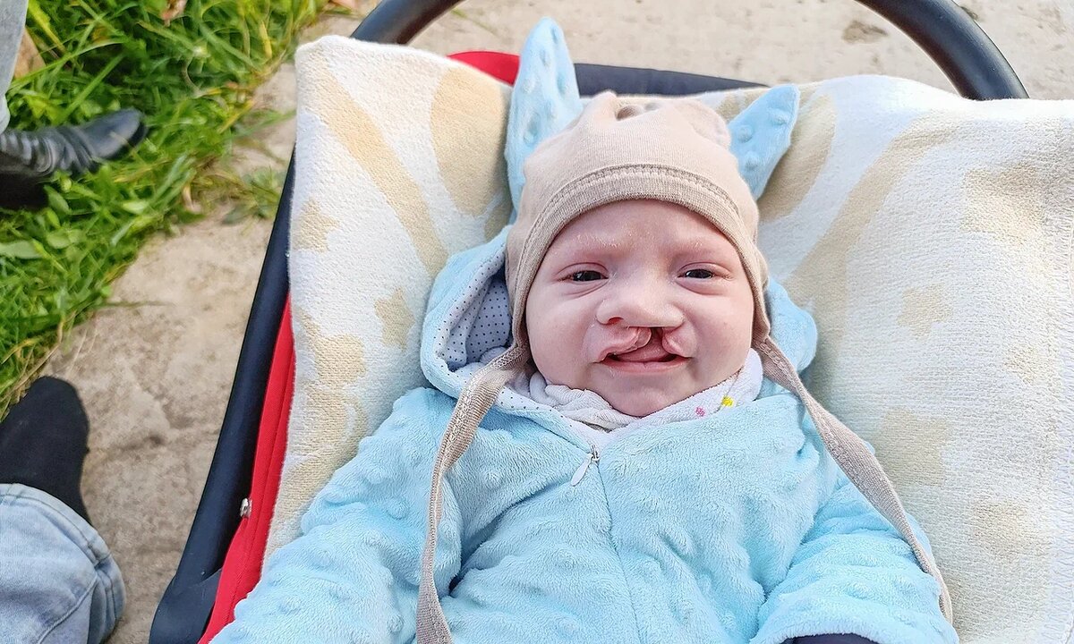 Сёма Волков, подопечный фонда «Алёша»