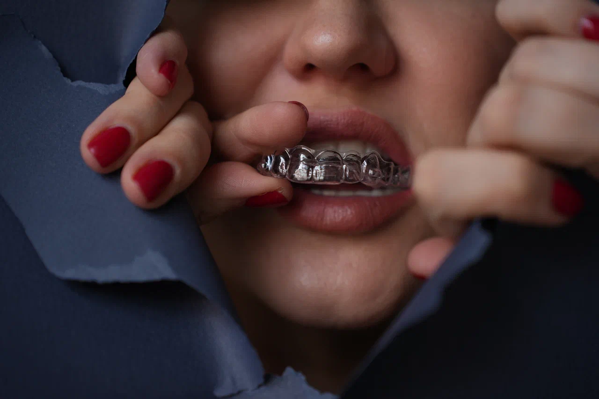 Восемь симптомов, которые говорят: пора менять пломбу 