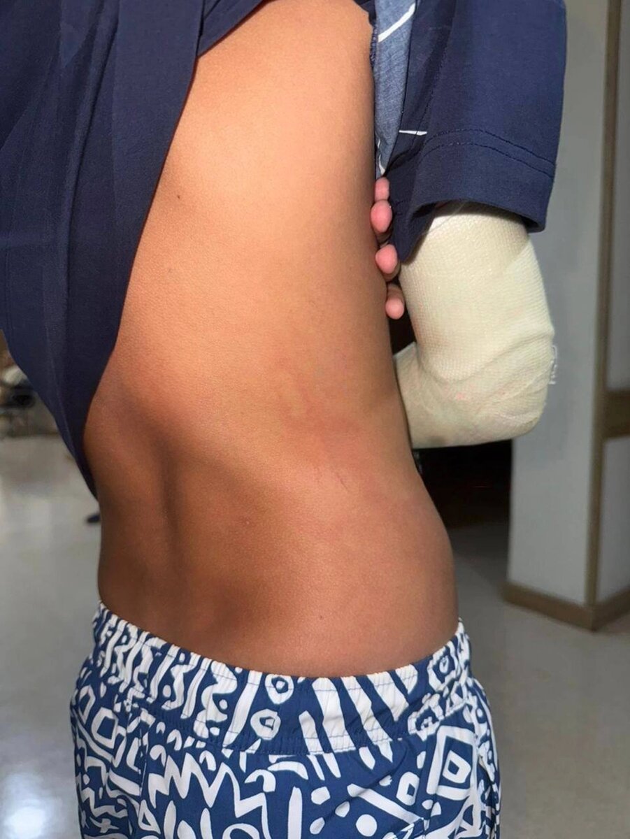    Последствия избиения подростка. Фото: соцсети