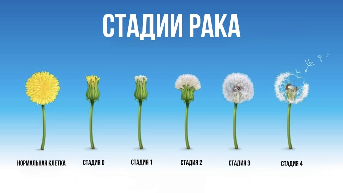 Елена Фёдоровна Сатирова – жизнерадостный онколог 