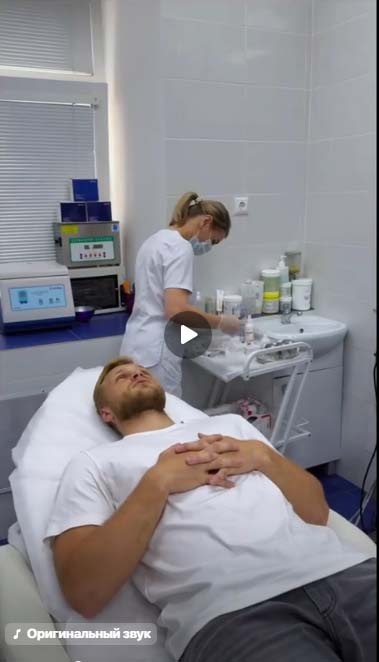 Микроигольчатый RF-лифтинг