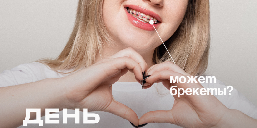 Брекеты или элайнеры?