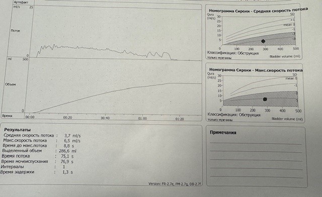 Рис. 1. График мочеиспускания пациента до операции.