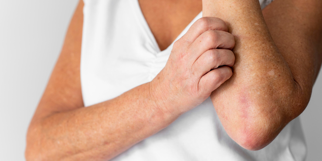 Почему чешется кожа без видимой причины