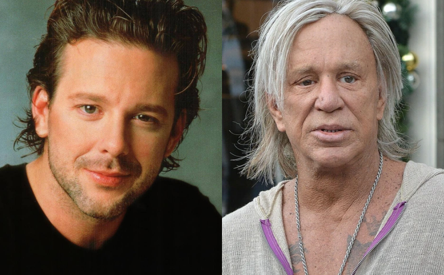 10 изветсных мужчин, которые испортили лицо пластикой