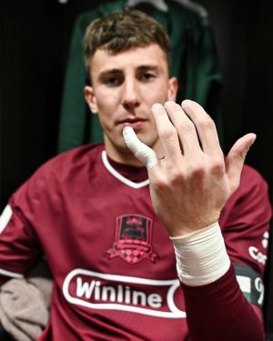    В апреле этого года Агкацев сломал палец, отбивая пенальти. / Фото: Официальный канал ФК "Краснодар"