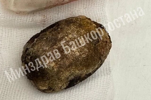    Фото: Минздрав Башкортостана