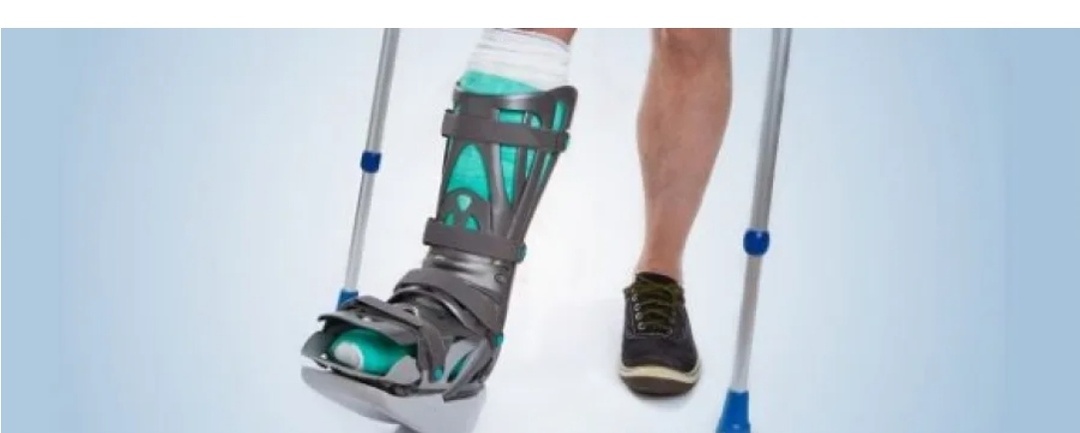 Что если случился надрыв связки голеностопа?