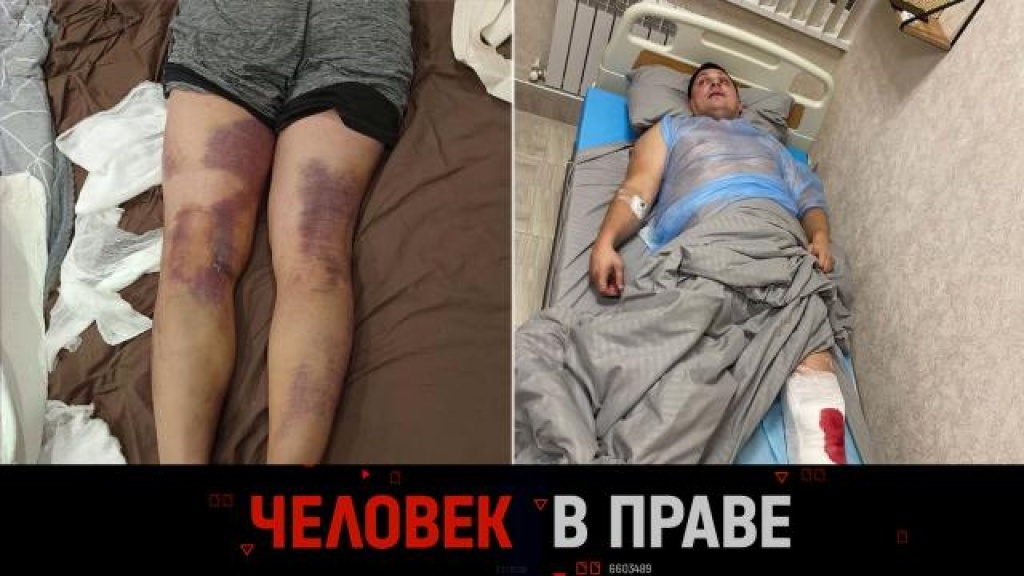    Домашний террор арендодателей и пределы необходимой самообороны