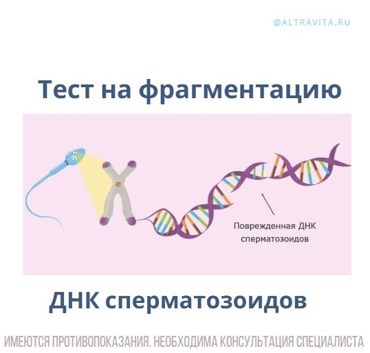 Тест на фрагментацию ДНК сперматозоидов