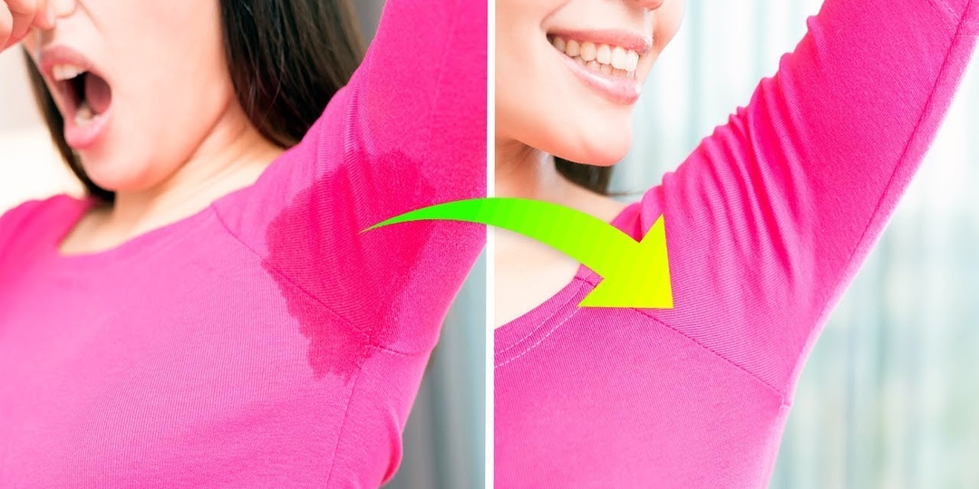 Когда потливость — это уже симптом болезни (чек-лист)