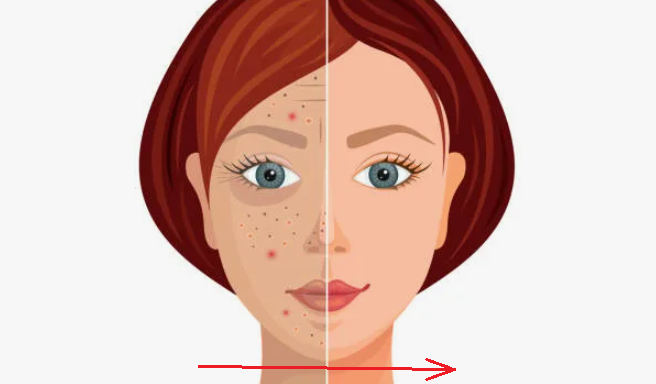 Они воруют молодость нашего лица: растираем 3 мышцы и возвращаем себе свежий, подтянутый вид