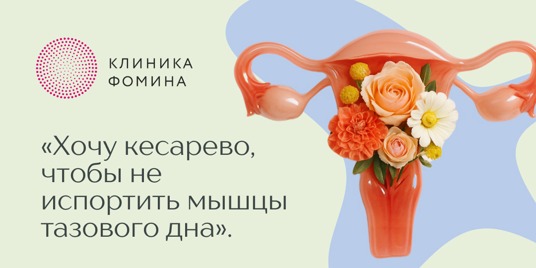 Кесарево, чтобы сохранить мышцы тазового дна: миф или реальность?