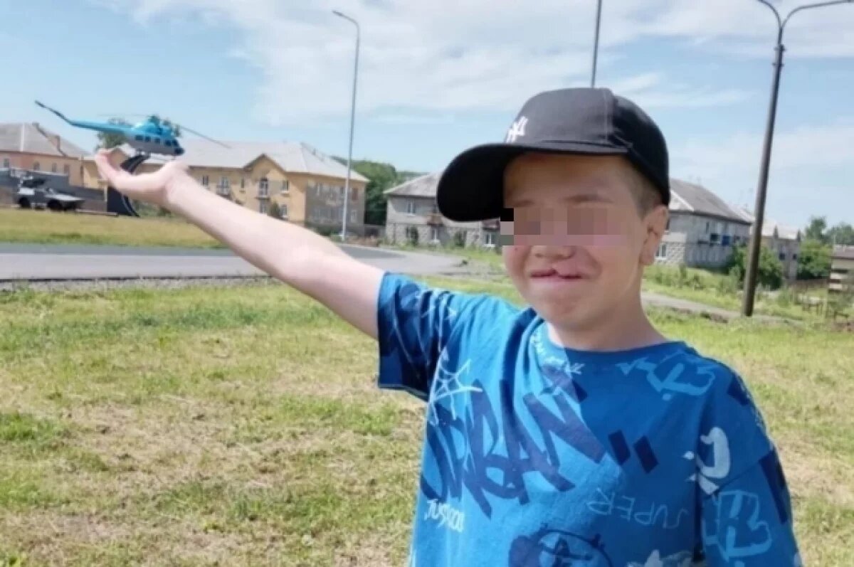    Мальчику с изуродованной губой из Кузбасса сделали пластическую операцию