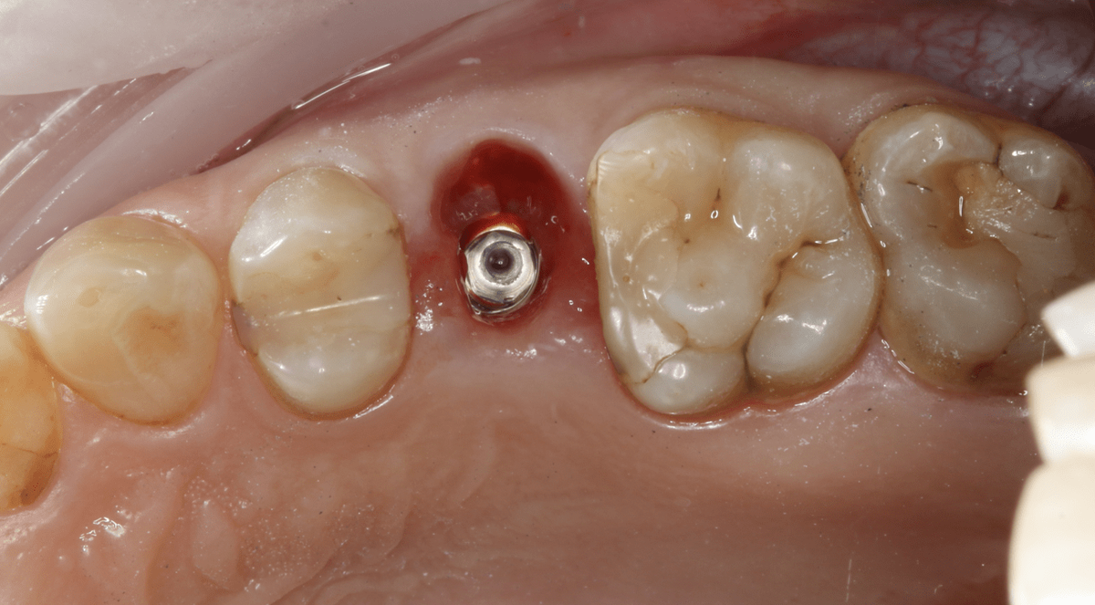 лечение зубов в стоматологической клинике Пробел