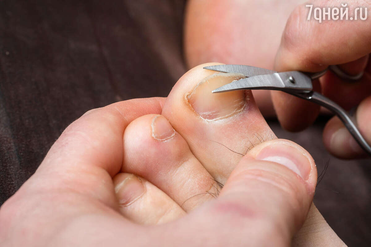    К чему стричь ногти во сне 123RF/legion-media.ru