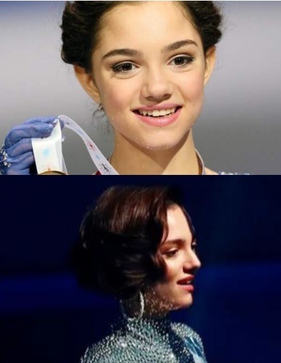 Медведева после пластических операций. соц сети фигуристки 