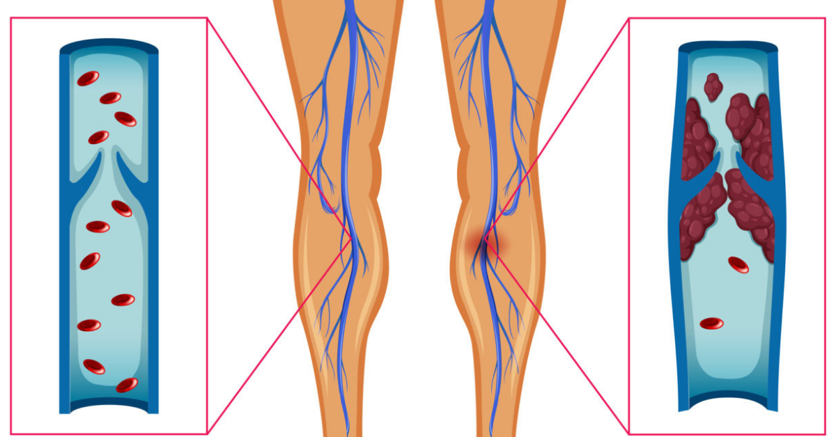 изображение взято с сайта beztabaka.by