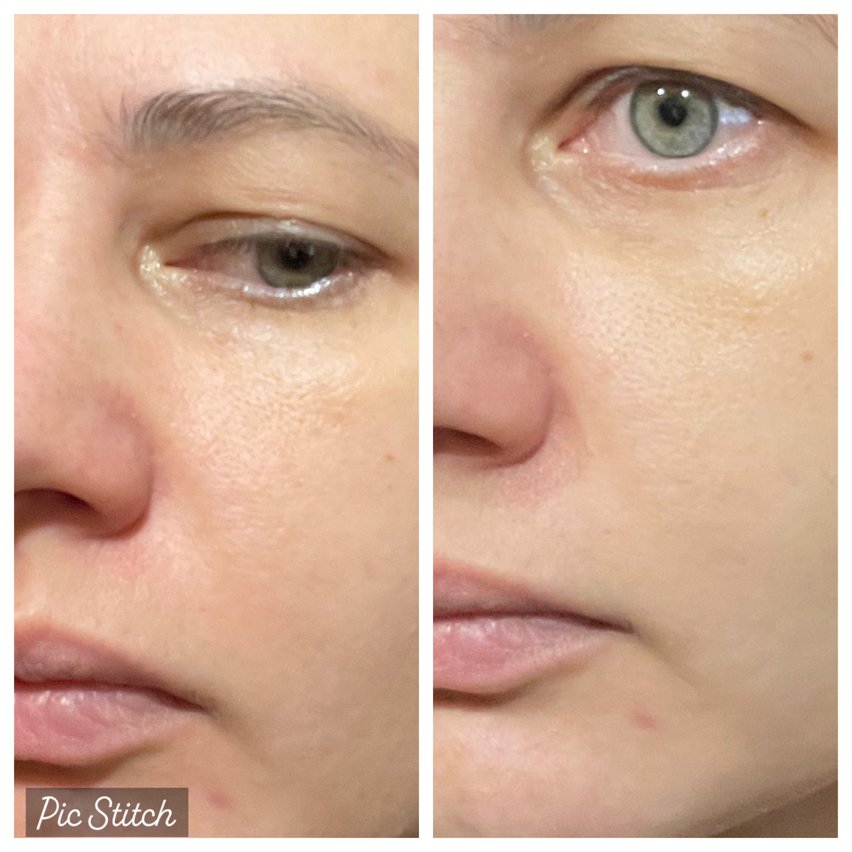 Фото после единоразового использования