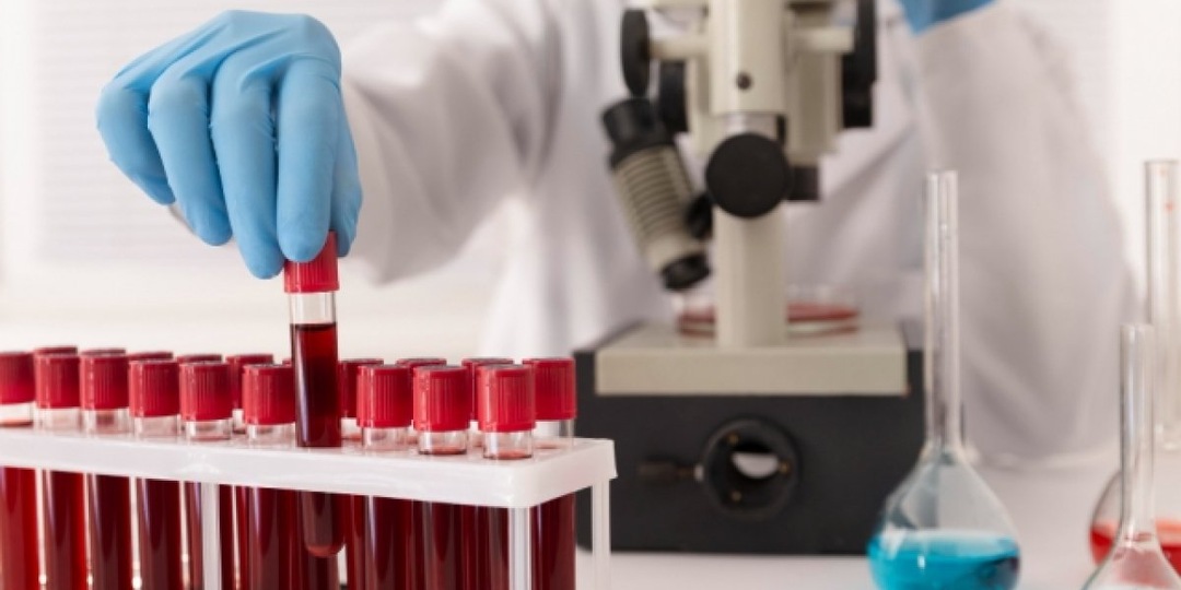 Почему анализы врут? Как ошибки, стресс и даже чашка кофе могут исказить результаты — и что с этим делать