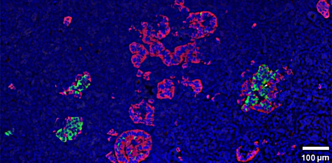 Новости про сахарный диабет: найден ген, заставляющий клетки производить «антипод» инсулину