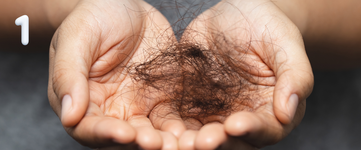 Видите волосы на подушке, кресле, в машине - их не должно быть слишком много.