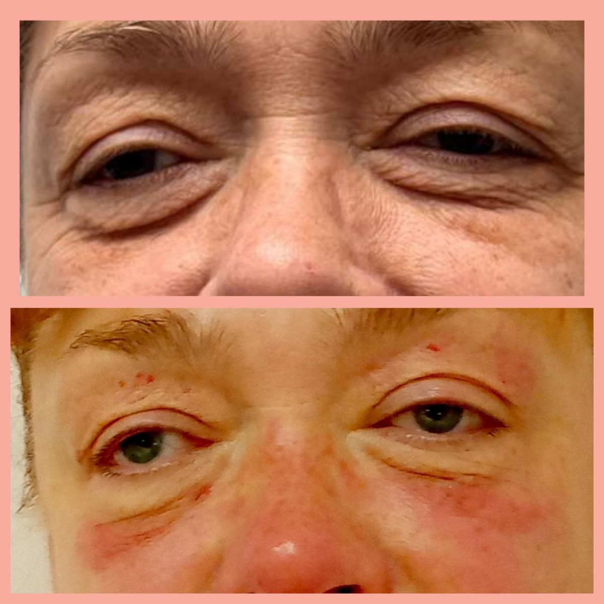 Результат моей работы после трех сеансов