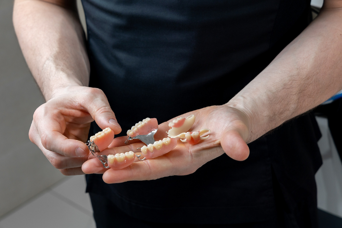 Бюгельные протезы