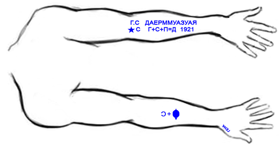 Рис. 1.  Схема рисунков на руке Семёна Золотарева. Из открытых источников.    
Изображение свеклы-туза, на Рис.1, не соответствует фактическому, их размеры на фото СМЭ значительно больше.
