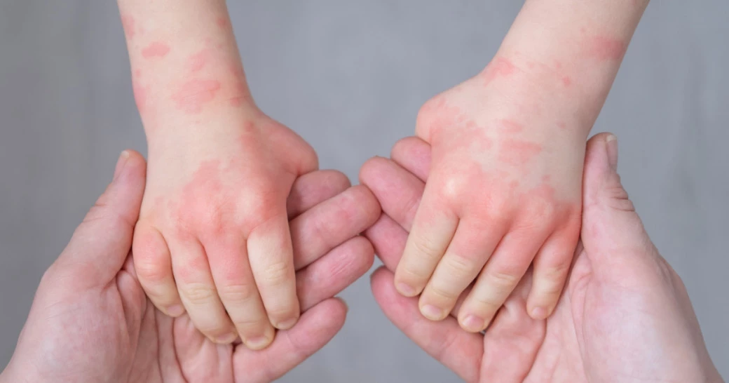 Фото: Shevtsova Yuliya | Shutterstock | Fotodom