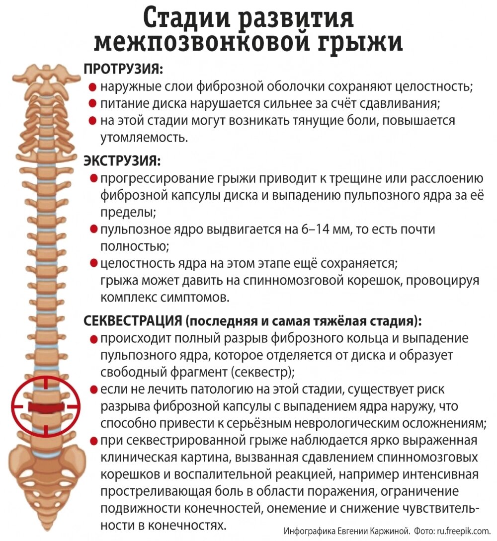    Фото: АиФ/ Евгения Каржина