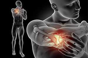 Боль в мышцах (крепатура): что это и как с ней бороться?