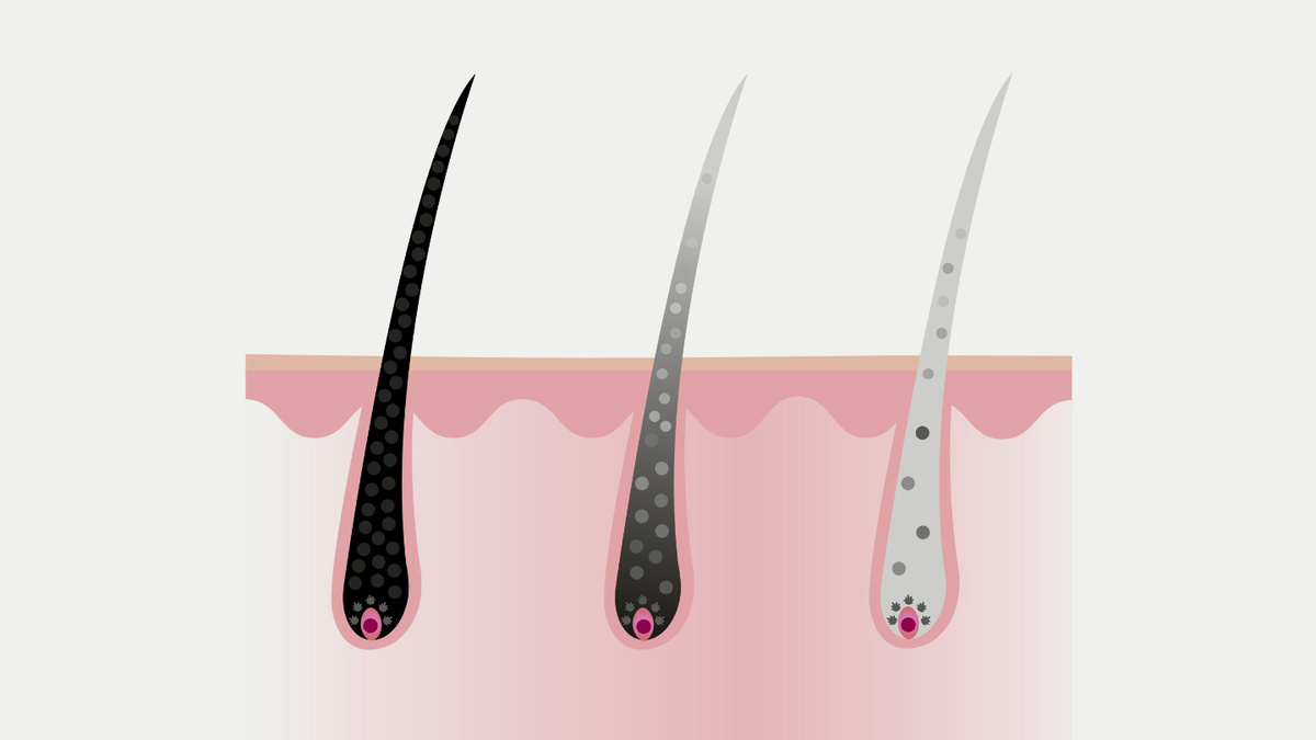     Фото: Mosterpiece/Shutterstock/FOTODOM В молодости наш организм производит достаточно фермента каталазы, который мгновенно расщепляет перекись водорода на воду и кислород. Но с годами выработка каталазы снижается. Перекись накапливается и блокирует работу ключевого фермента тирозиназы, отвечающего за синтез пигмента меланина, который и придает волосам цвет