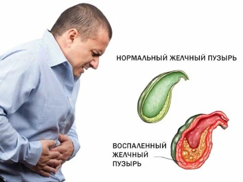 Желчь застоялась — что делать?: простыми словами о застое желчи, его причинах и как вернуть всё в норму