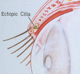 источник фото: https://oculusvet.ru/upload/images/%D0%A1%D0%BE%D0%B1%D0%B0%D0%BA%D0%B8/distikhiaz3.png