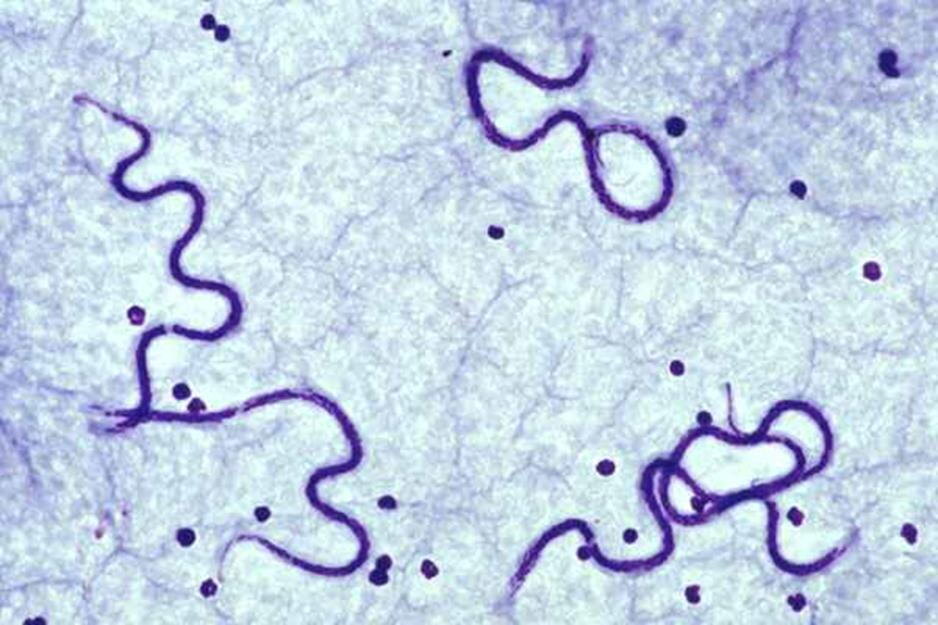 Дирофилярии под микроскопом