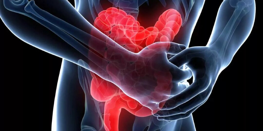 Воспалительные заболевания кишечника (ВЗК): как распознать, лечить и вернуть себе нормальную жизнь