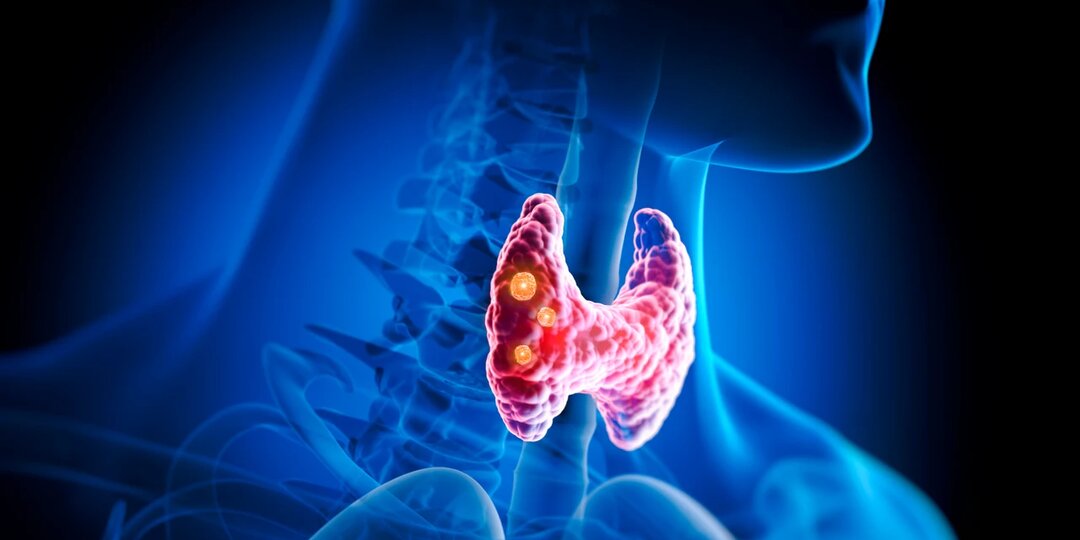 Почему щитовидка «глючит»: 8 причин, которые мешают ей работать как надо