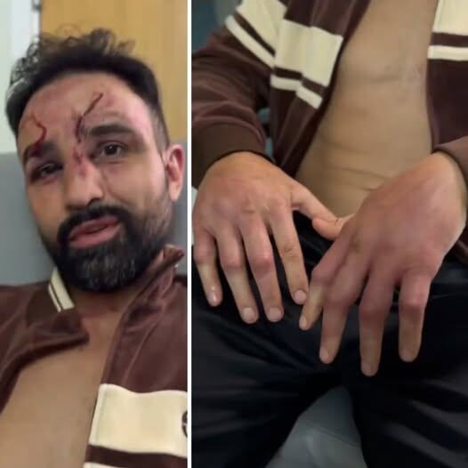 Поли Малиньяджи после боя