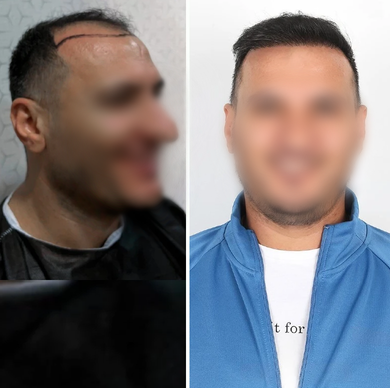 Фото с сайта https://elitclinic.su