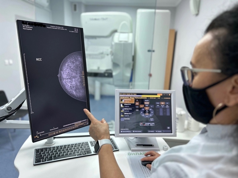    В Югре в 84% случаев рак молочной железы выявляют на ранних стадиях, когда лечение более результативно