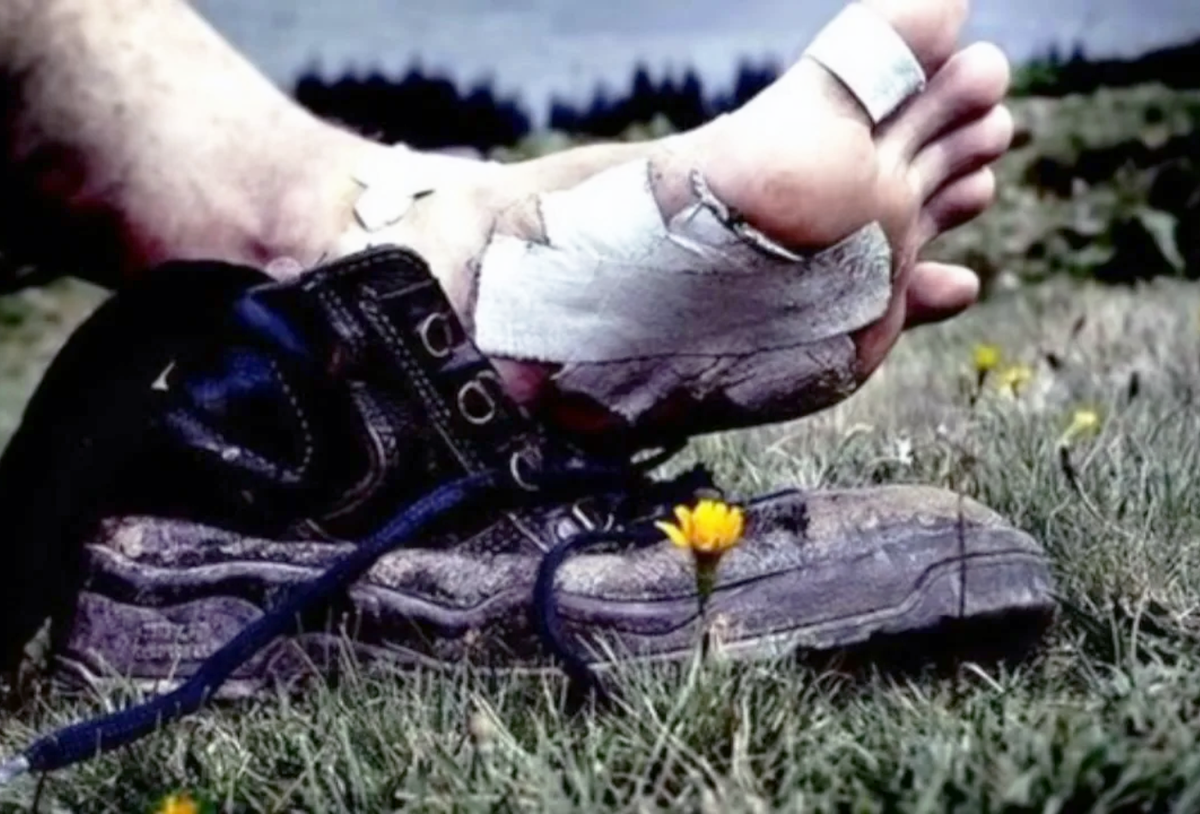 Какая боль, какая боль - опять мозоль?