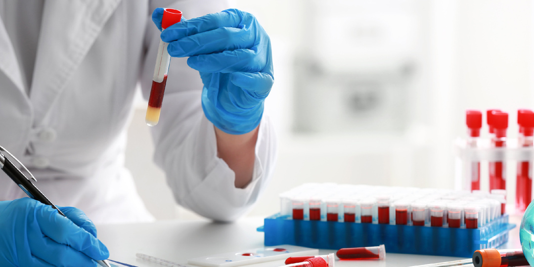 Как разобраться в биохимическом анализе крови: расшифровка без паники и сложных терминов