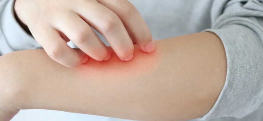 Ах как приятно почесать, когда зудит. Главное - не переборьщить!